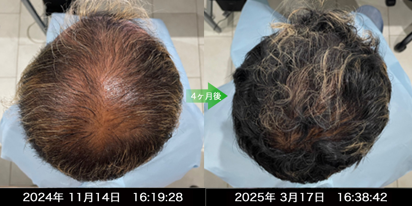 男性40代